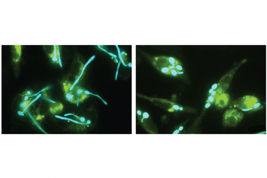 Yeast cells with and without treatment of a small molecule