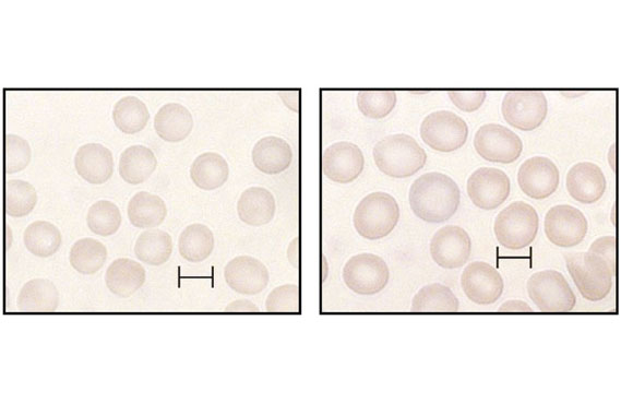Microscope images of mouse blood samples