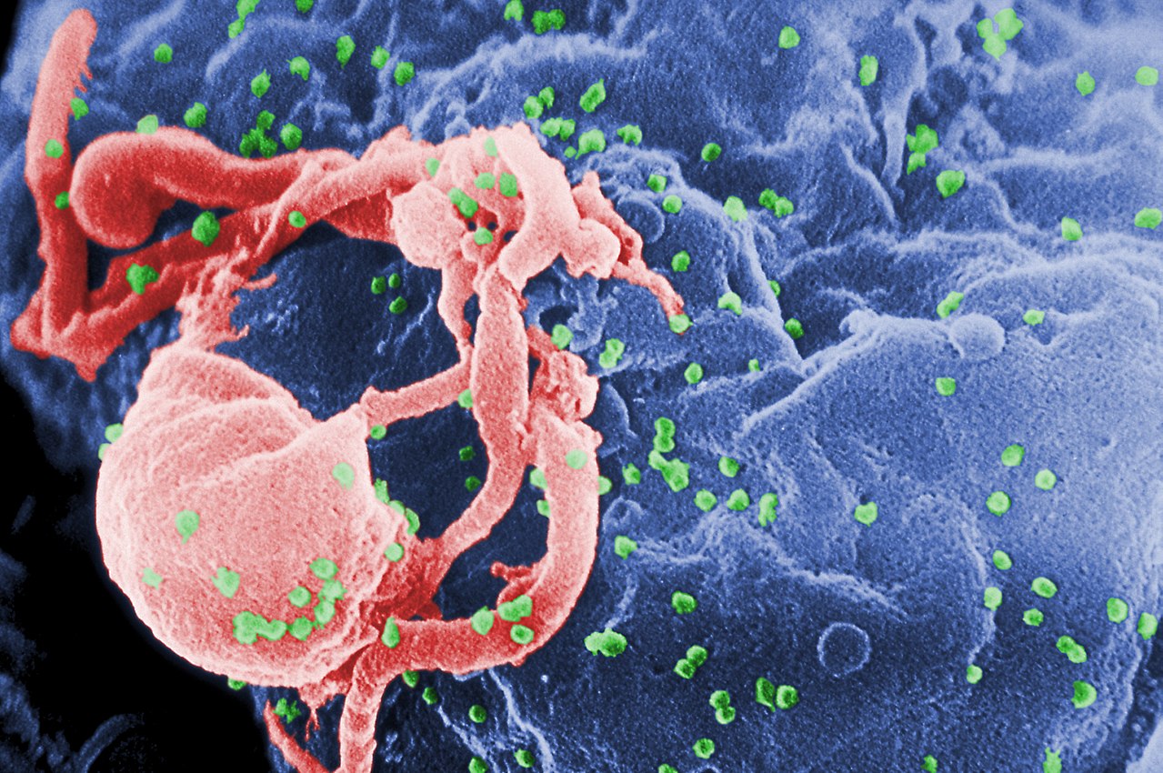 Green HIV viruses bud on a blue cell.