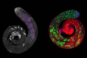 Drosophila testes with stain — two curly colorful shapes with patches of different colors.