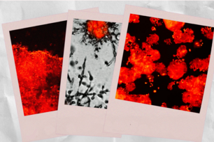 Cells in Context_cancer