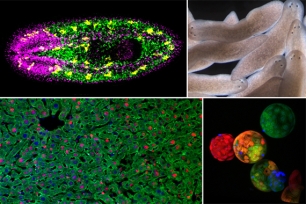 Collage of images in regeneration piece: Planarians, liver cells, and stem cells