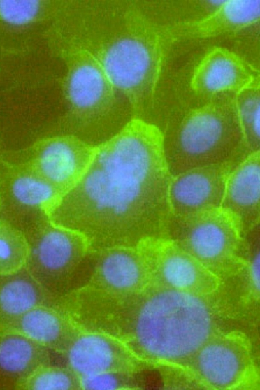 Normal cells transformed into cancerous ones