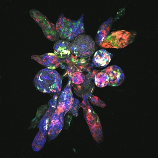 Mammary organoid with cells in bright colors