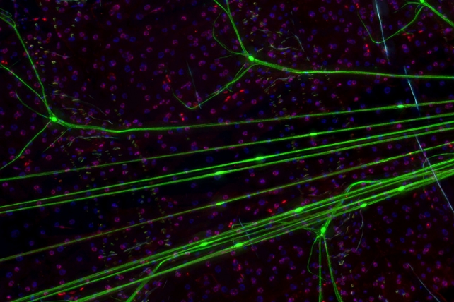 Cells in Drosophila