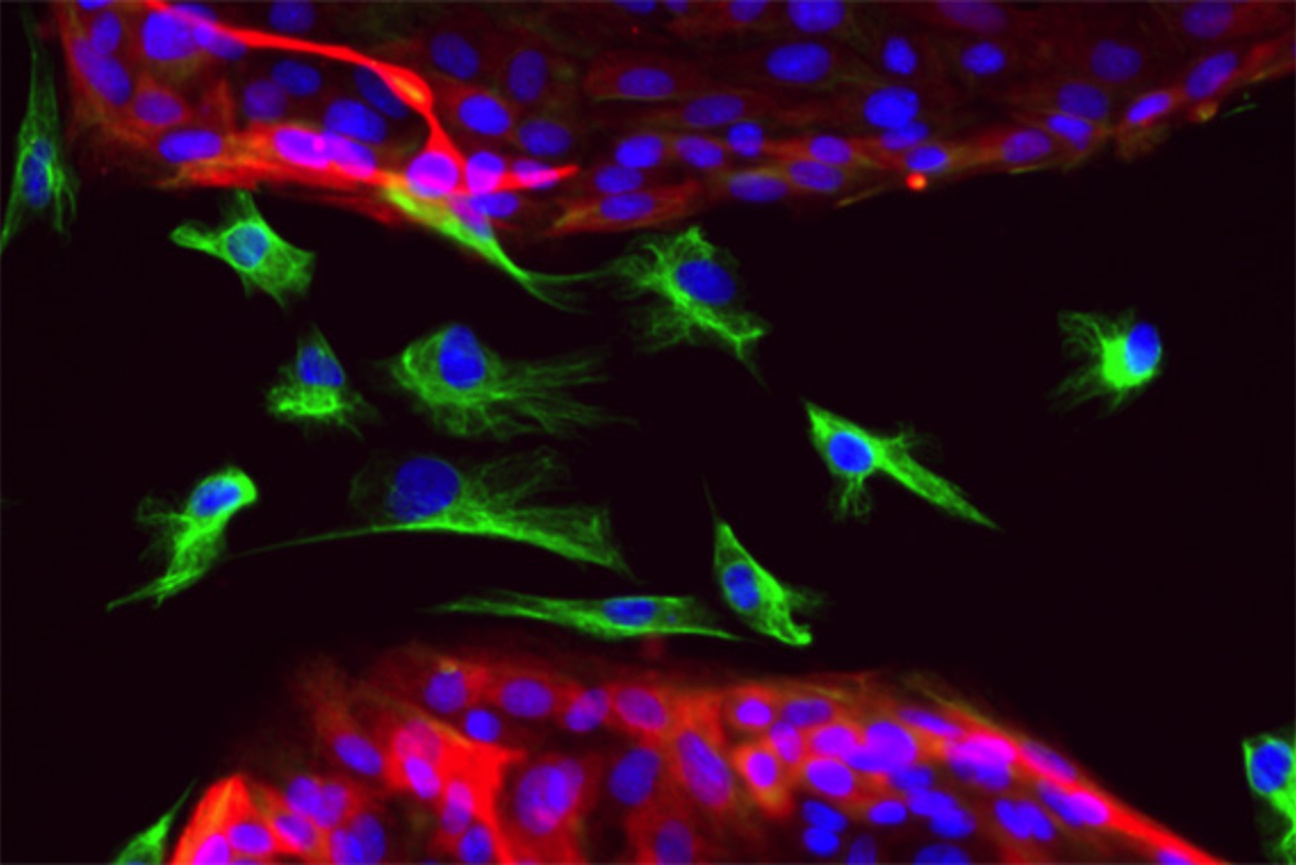 Green and blue cells on a black background.