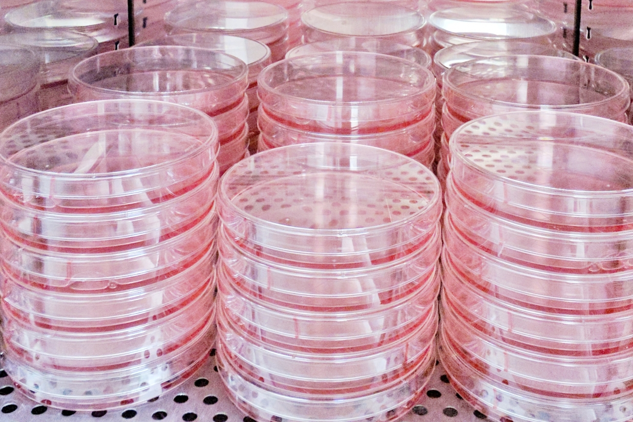 petri dishes filled with culture media.