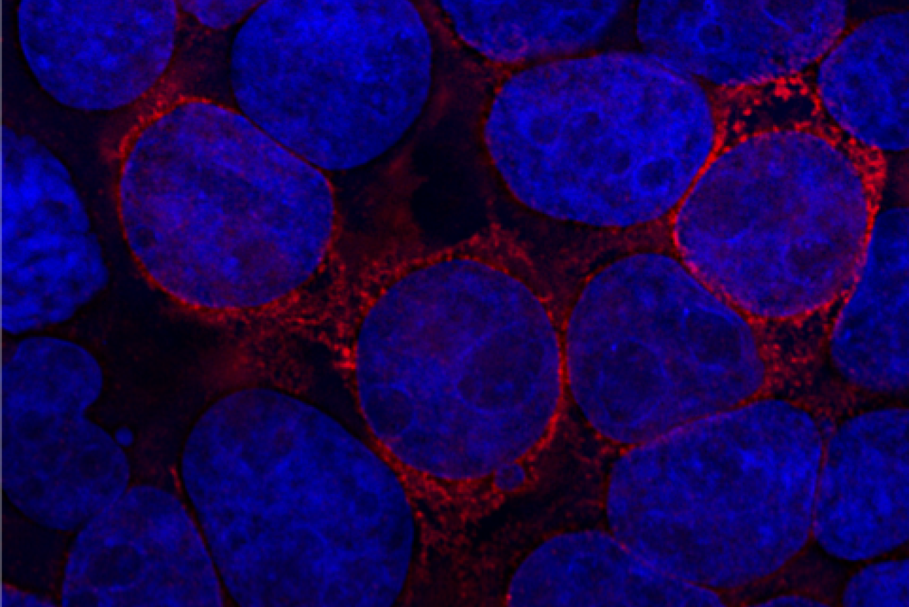 Understanding SARS-CoV-2-Mediated Inflammatory Responses: From