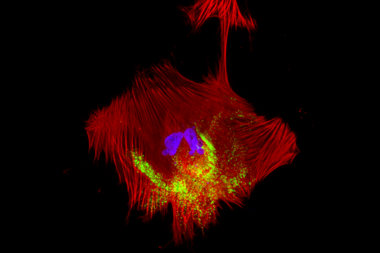 A smooth muscle cell that looks like a parallelogram in red, with strings of green inside of it