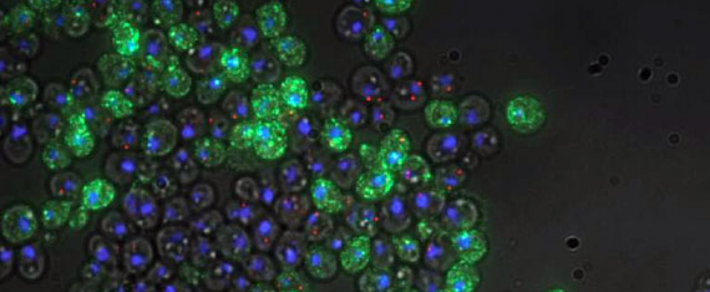 Microscopy image of yeast cells