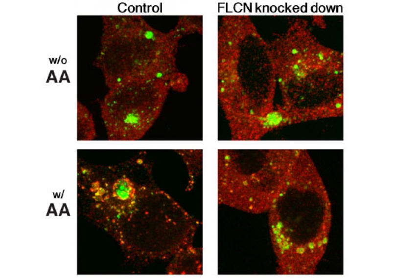 Panel showing cells in which mTORC1 is activated and not activated