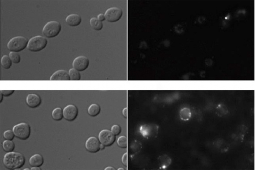On the left, two images of groupings of cells. On the left, white in the same spots as some of those cells (one on top, multiple on bottom)