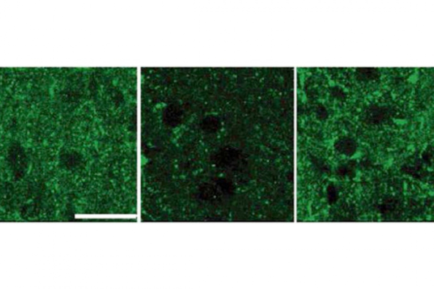 Three panels in a row: slides of mouse brain samples. The middle image has less green.