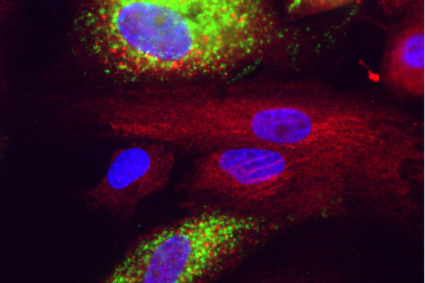 Covid in liver cells. Green is dsRNA, red is calreticulin, blue is nuclei stained with DAPI.