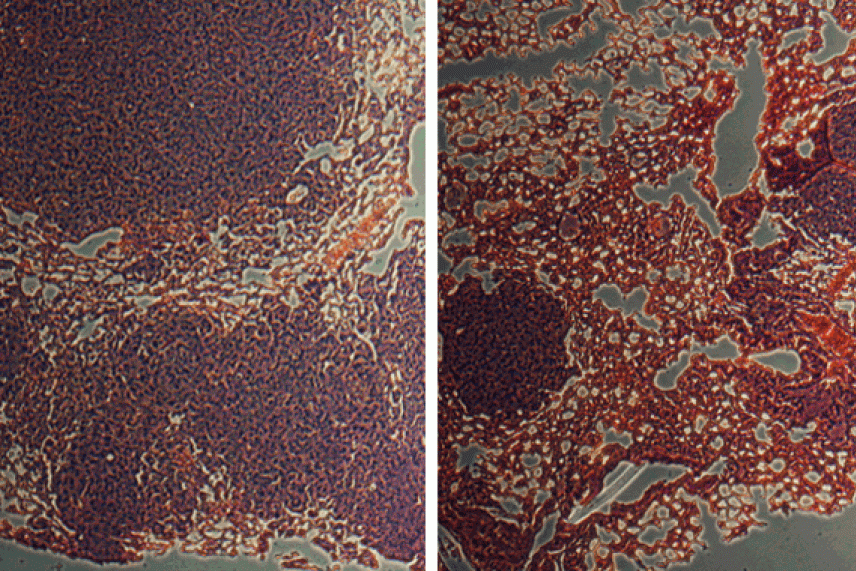 Images of mouse lung cells untreated and treated with a PERK inhibitor