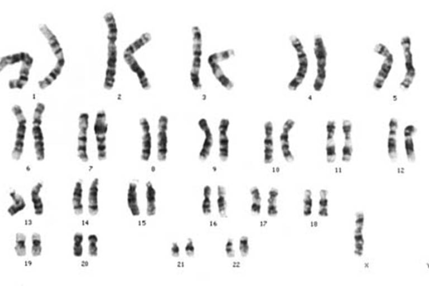  human chromosomes