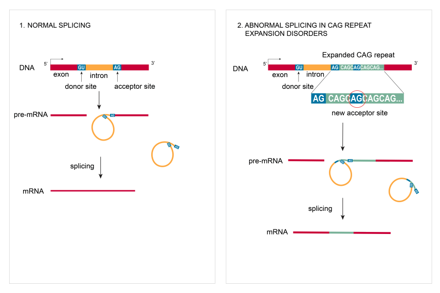 Diagram of normal splicing (left) and abnormal splicing in CAG repeat expansion disorders (right)